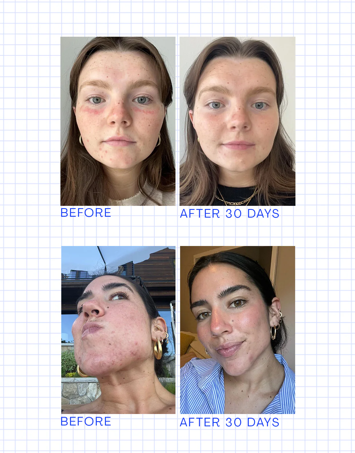 Daily Essentials Regimen Refill Bundle - Image 5