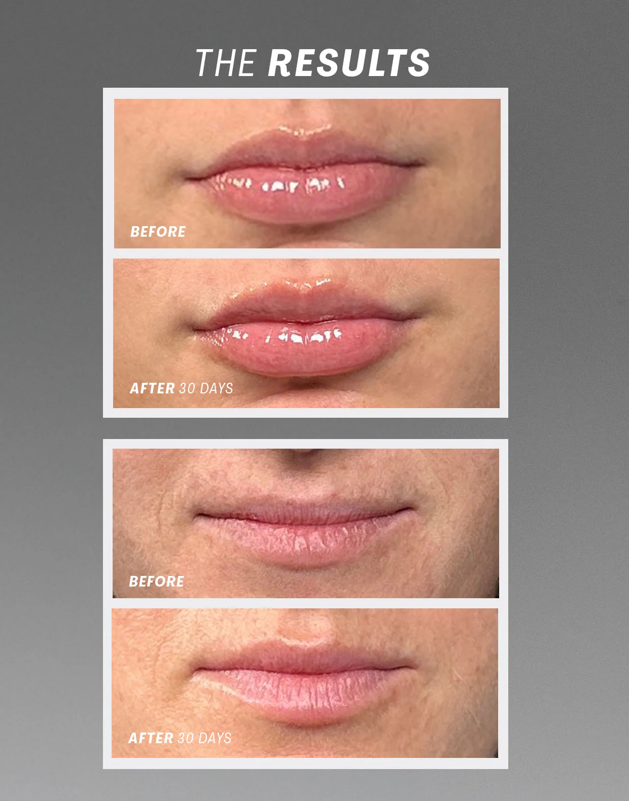 Lip Oasis™ Glossy Treatment - Image 6