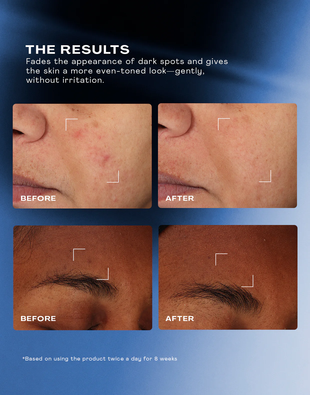 Total Clarity Dark Spot Serum - Image 6